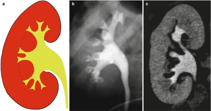 figure 58