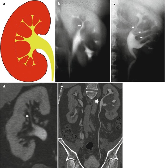 figure 64