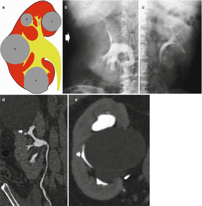 figure 65