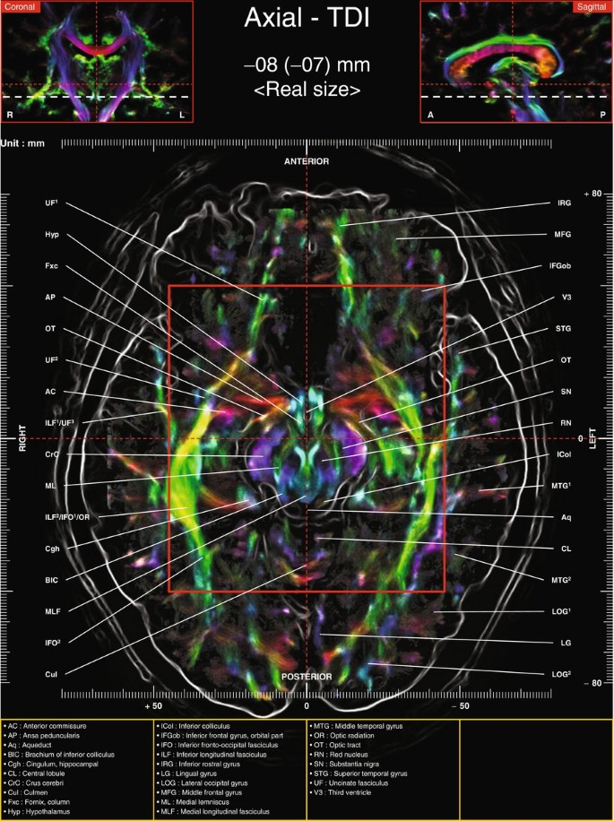 Axial Images Of Tractography And Corresponding In Vivo 7 0 T Mri Anatomy Springerlink