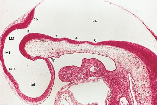 figure 15