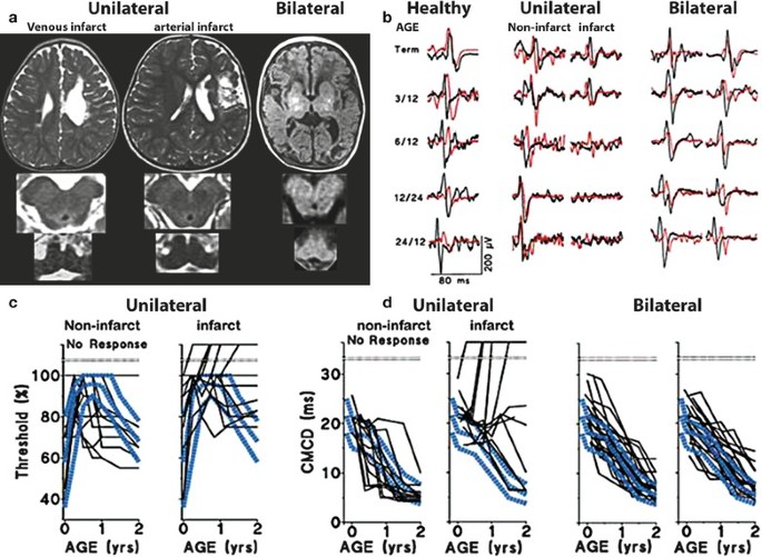 figure 29