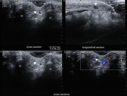 figure 22