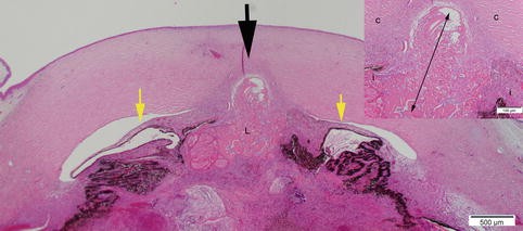 figure 28