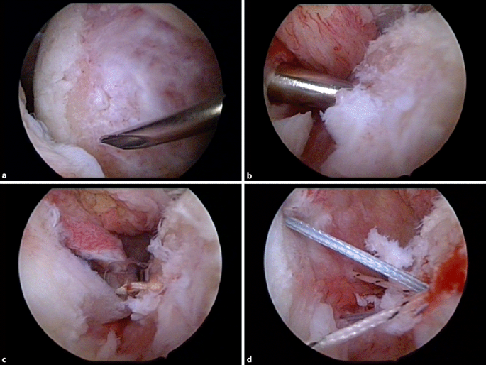 figure 35