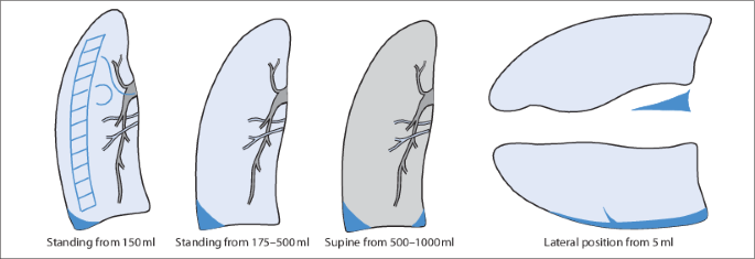 figure 117