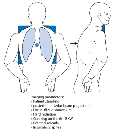 figure 23