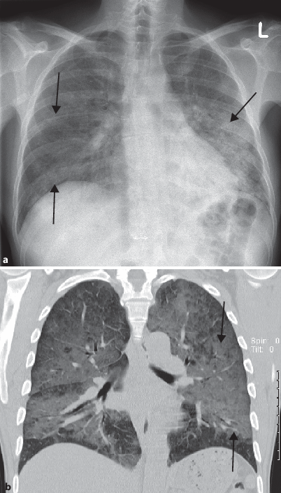 figure 54