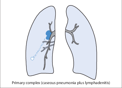 figure 55