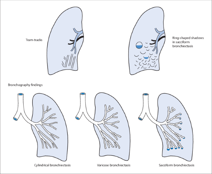 figure 61