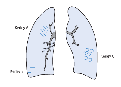 figure 95