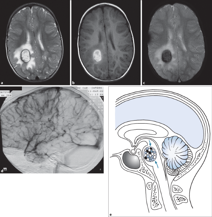 figure 45