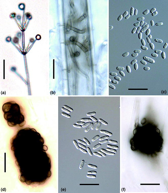 PDF) Biological Characteristics of Verticillium dahliae MAT1-1 and