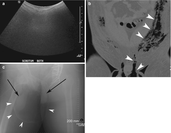 figure 26