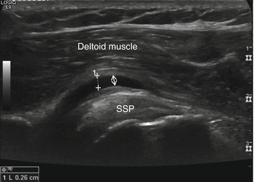 figure 53