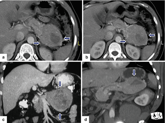 figure 28