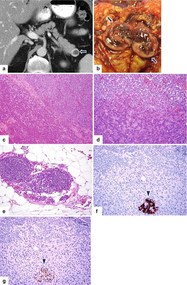 figure 29