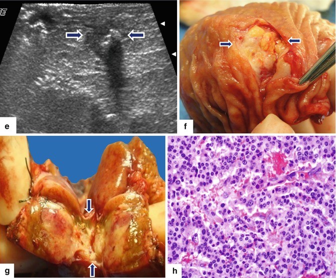 figure 34