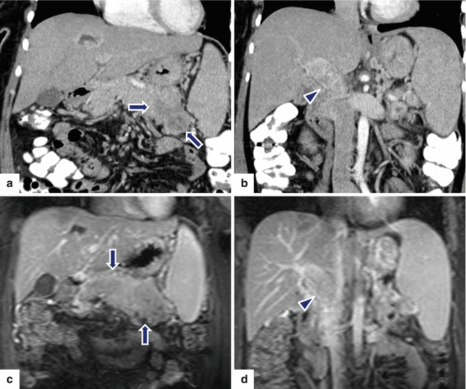 figure 43