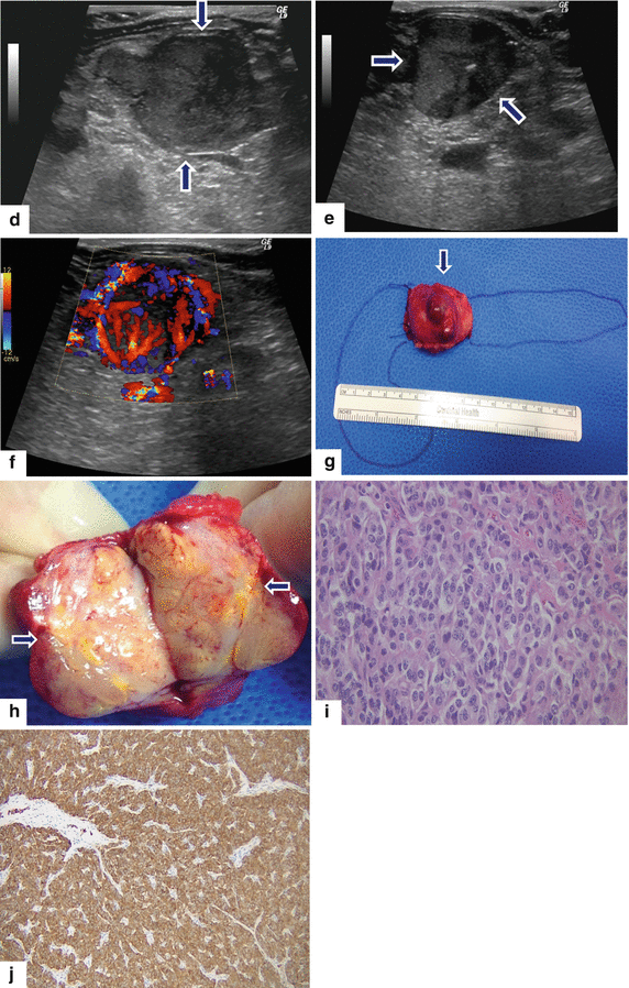 figure 46