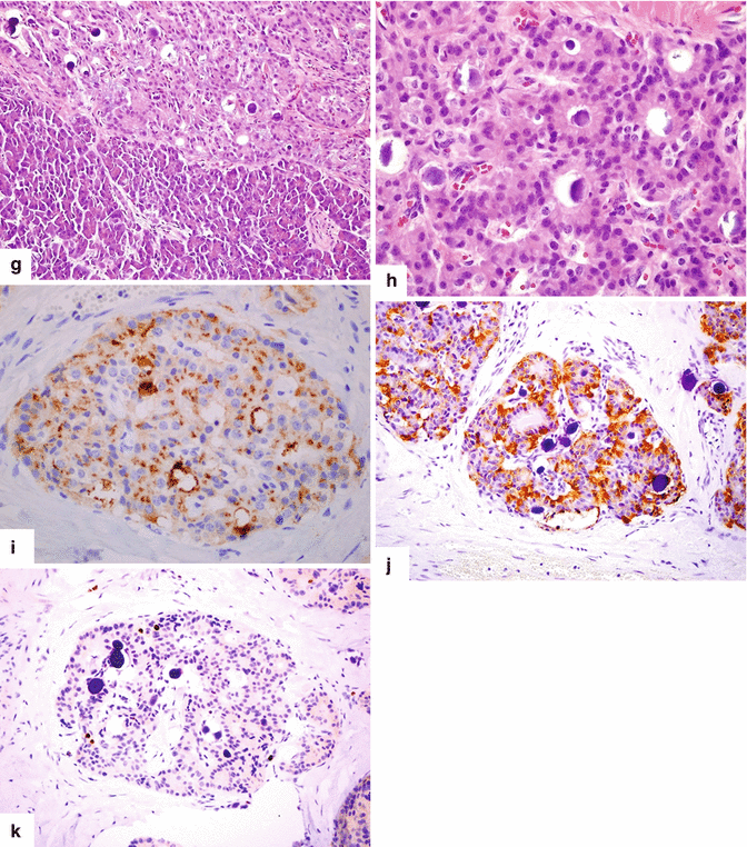 figure 57