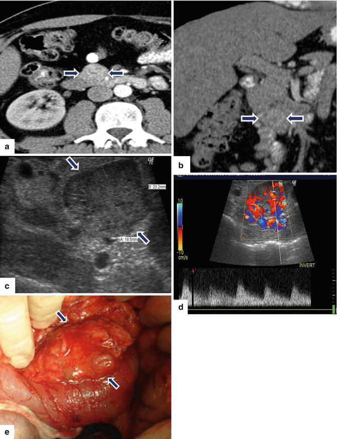 figure 60