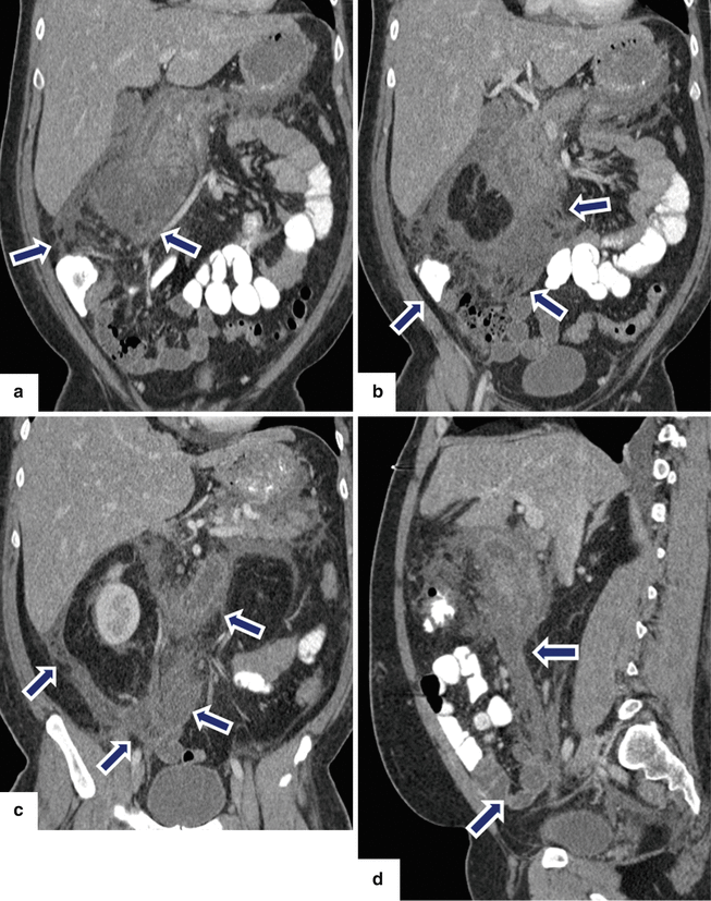 figure 23