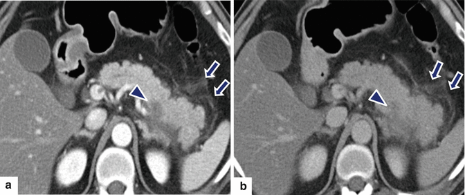 figure 25