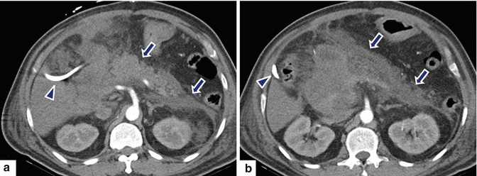 figure 29