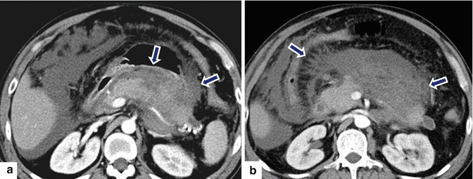 figure 31