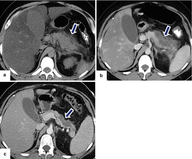 figure 36