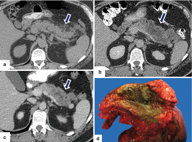 figure 37