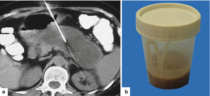 figure 43