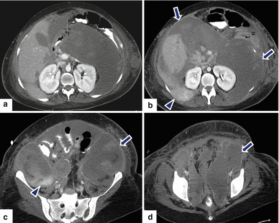 figure 44