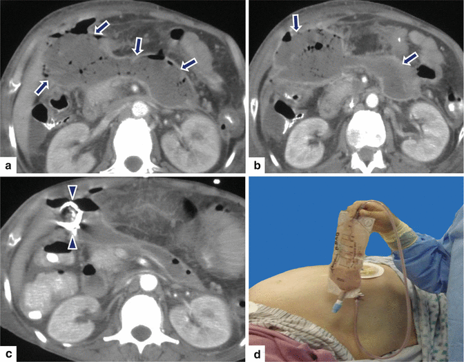 figure 46