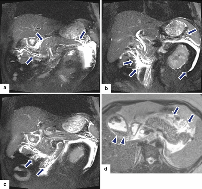 figure 51