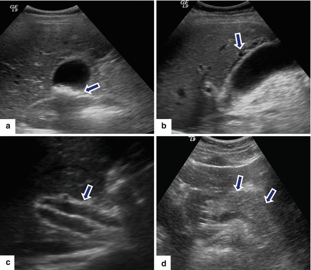 figure 52