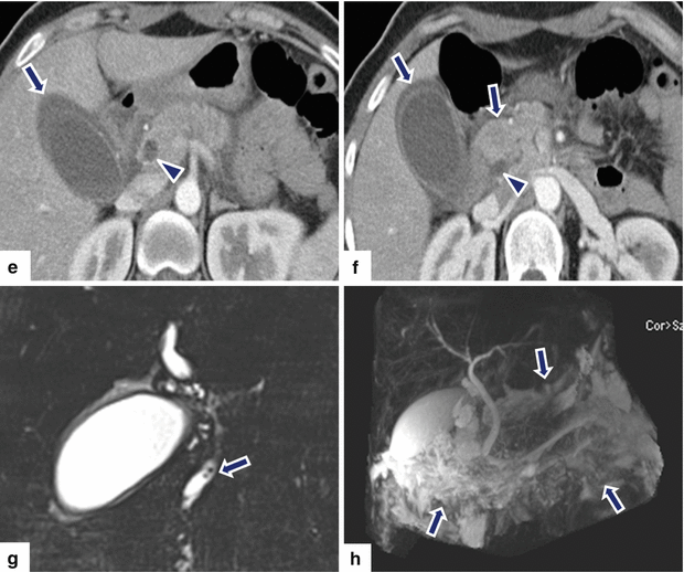 figure 52