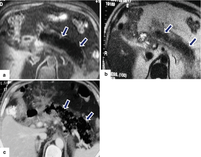 figure 54