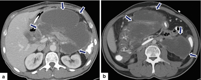 figure 57