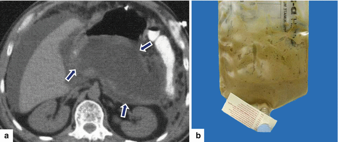 figure 61