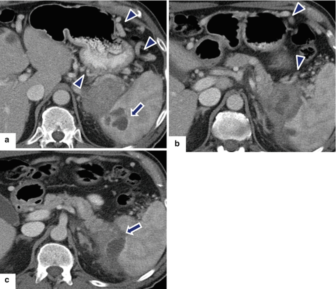 figure 68