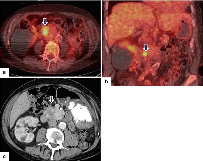 figure 33