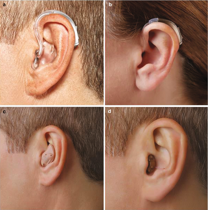 30 Pcs Ear Sticker Solves, Elf Ear Tapes Big Ear Problem Invisible Ear Tape  Ear Lobe Support Patches