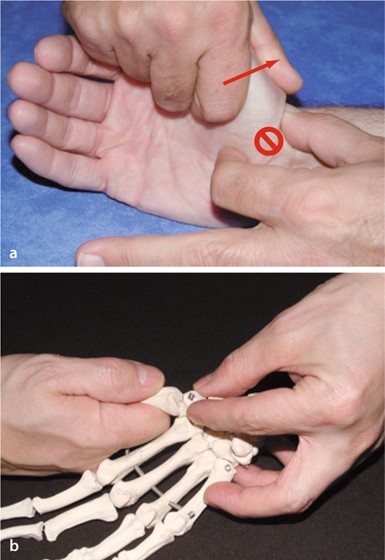 Manuelle Therapie und Rehabilitation der Hand | SpringerLink
