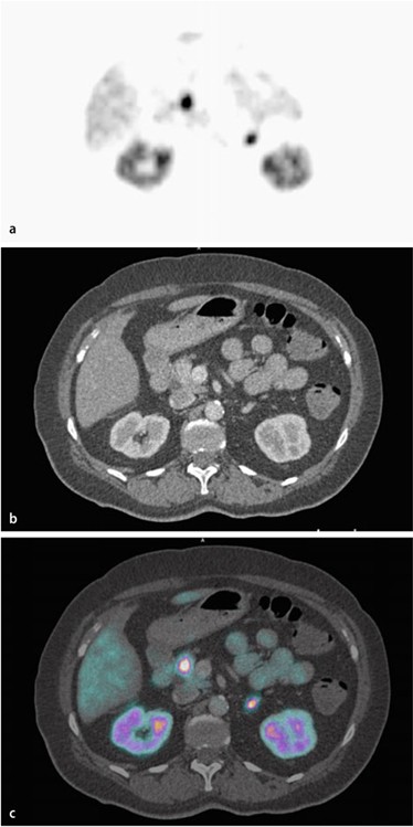 figure 25