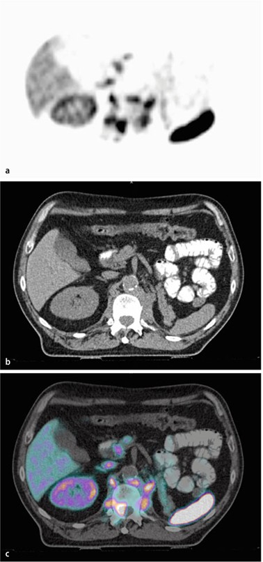 figure 27