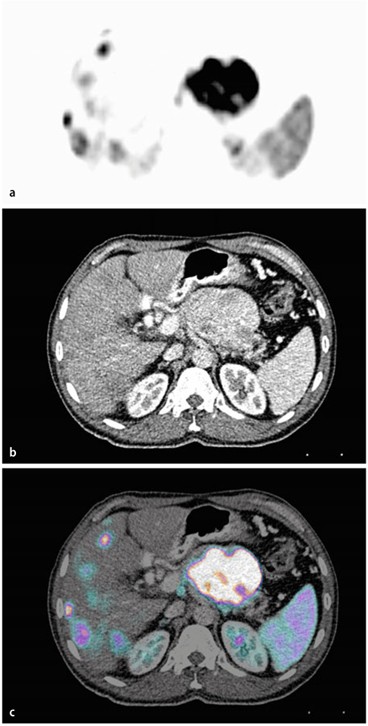 figure 32