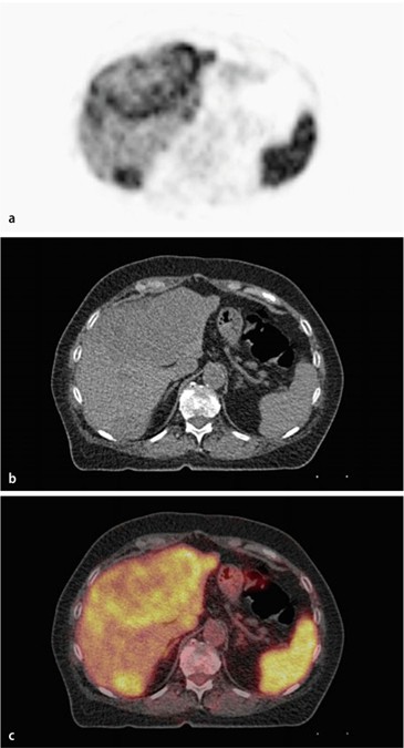 figure 33