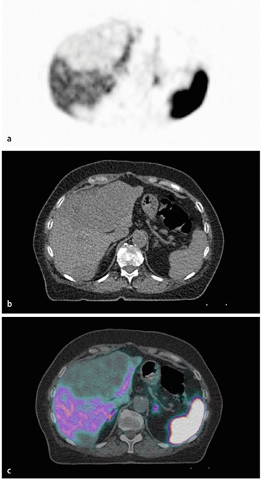 figure 34